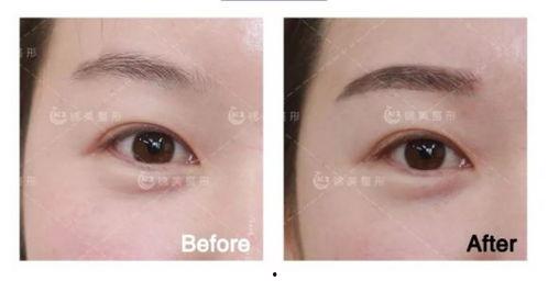 眉毛间隙短的明星,短间隙眉毛明星盘点